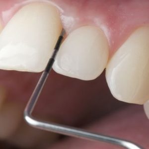 Dental Anja Kastav Rijeka Fiume Parodontologija