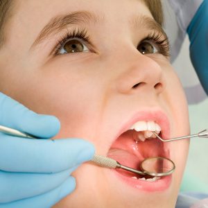 Dental Anja Kastav Rijeka Fiume pedodoncija