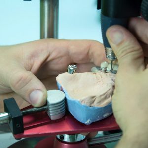 Zubotehnicki laboratorij Dental Anja Kastav Rijeka Fiume 1